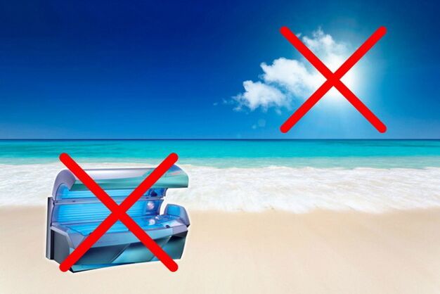 įdegis su venų varikoze